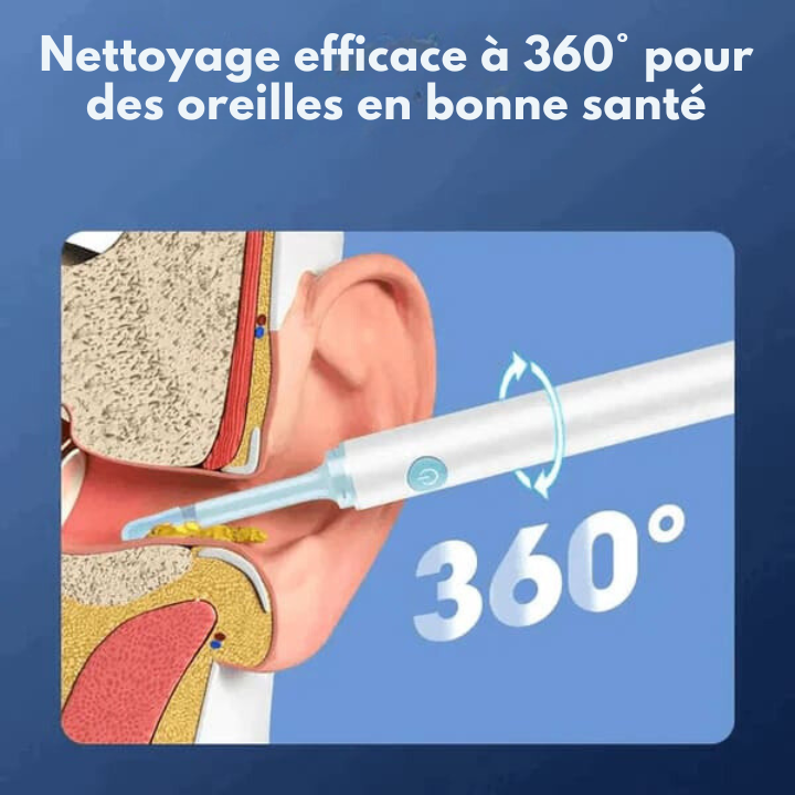 Appareil Nettoyage Oreille avec Technologie HD