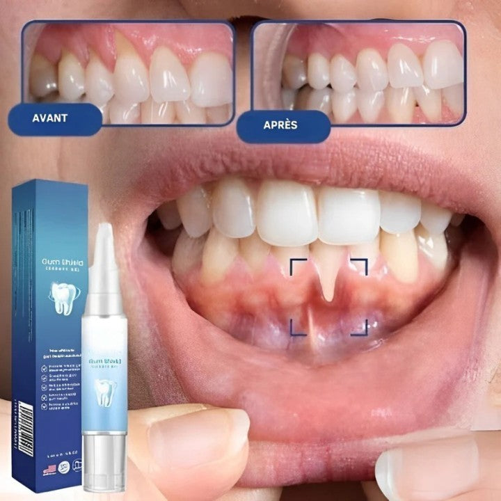 Gel pour Gencives® | Soigne et Apaise